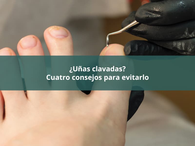 uñas clavadas ciudad real